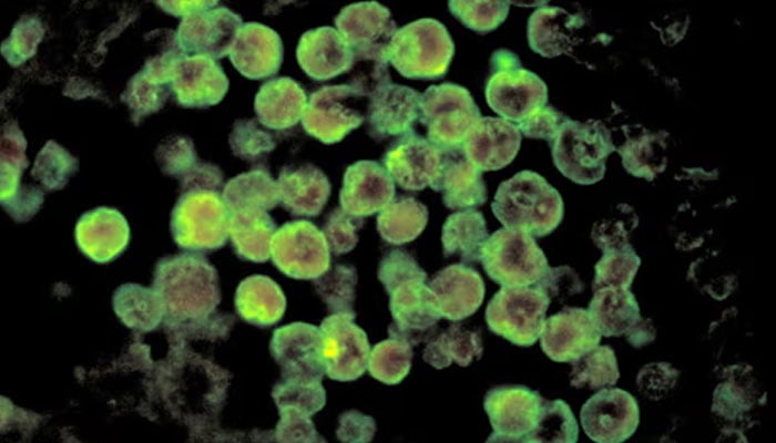 Karachi reports fourth Naegleria death of...